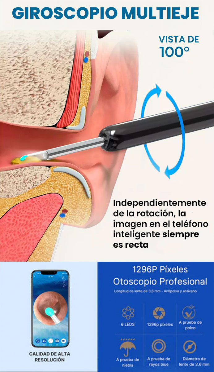 Ceruclear™ – Limpieza de oídos segura y visible (HD + LED + App)