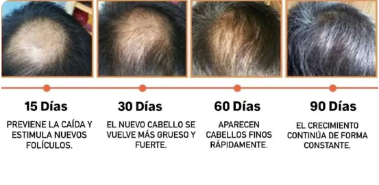 Disaar™ Pack Anticaída 90 Días – Frena la caída y activa el crecimiento