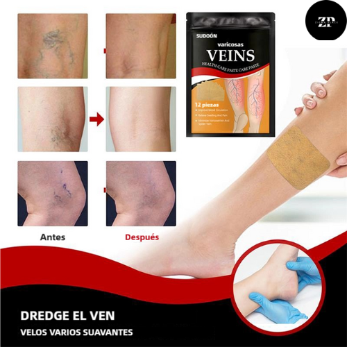 Compra 2 Parches Anti Várices y llévate 2 MÁS GRATIS (48 tiras)