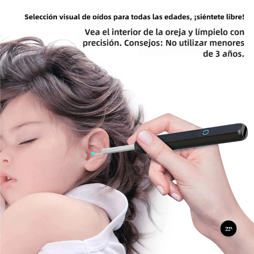 SmartScope WiFi – Otoscopio Digital de Alta Precisión 🔎📱 (30% OFF)