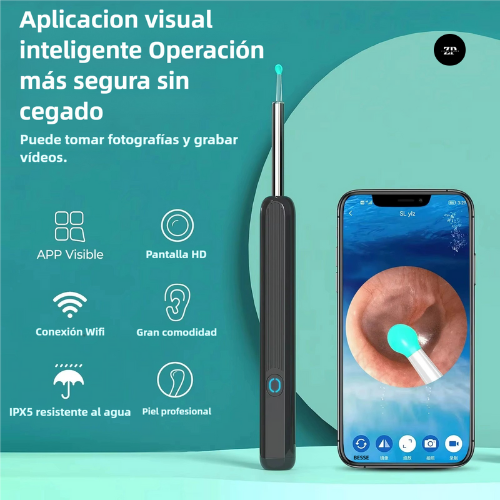 SmartScope WiFi – Otoscopio Digital de Alta Precisión 🔎📱 (30% OFF)