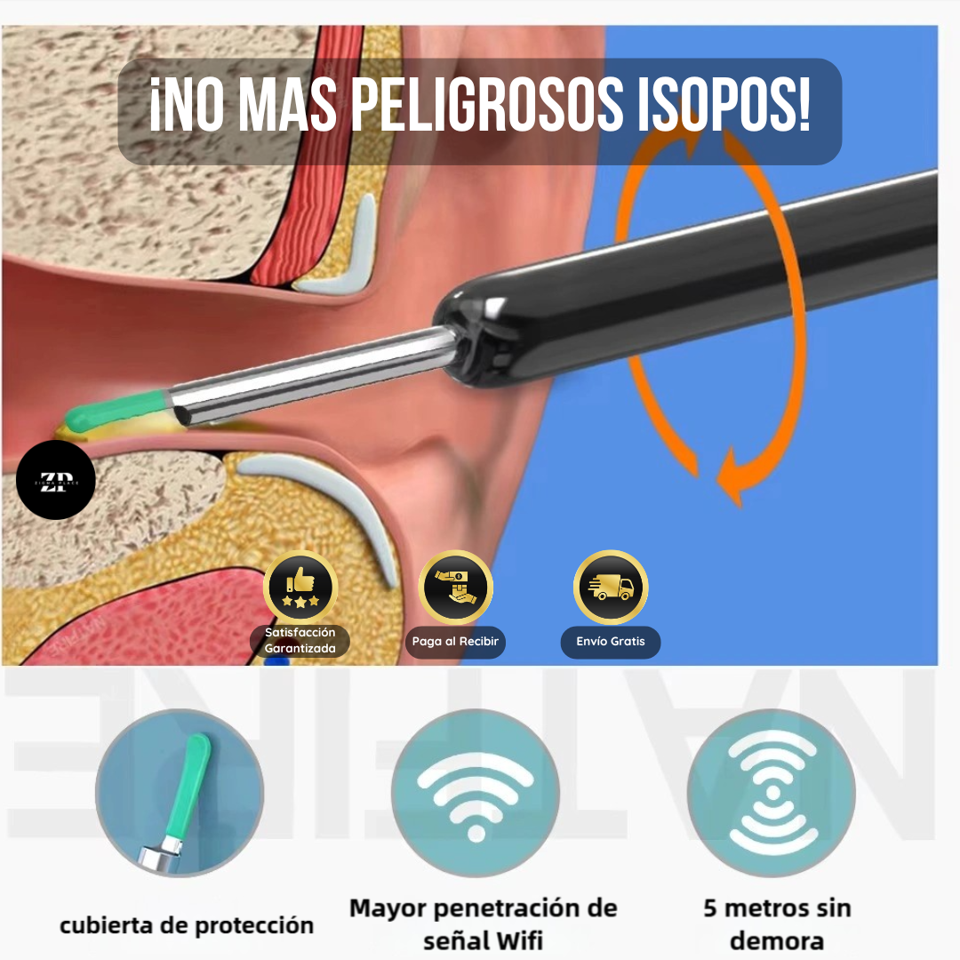 SmartScope WiFi – Otoscopio Digital de Alta Precisión 🔎📱 (30% OFF)