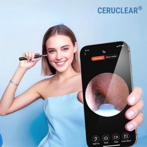 Ceruclear™ – Limpieza de oídos segura y visible (HD + LED + App)