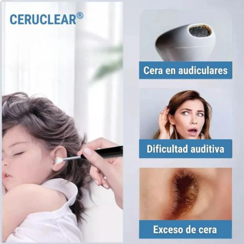 Ceruclear™ – Limpieza de oídos segura y visible (HD + LED + App)