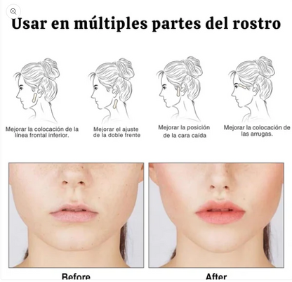 Parches Antiedad Tirante™ – Reduce arrugas y flacidez en minutos