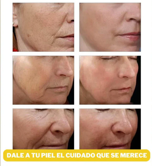 2x1 Sérum Gold 24K – el suero que rejuvenece tu piel en semanas, sin tratamientos caros ni complicaciones