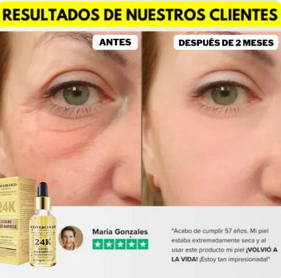 2x1 Sérum Gold 24K – el suero que rejuvenece tu piel en semanas, sin tratamientos caros ni complicaciones