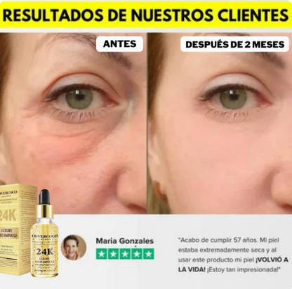 2x1 Sérum Gold 24K – el suero que rejuvenece tu piel en semanas, sin tratamientos caros ni complicaciones