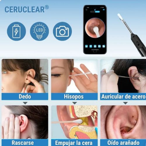 Ceruclear™ – Limpieza de oídos segura y visible (HD + LED + App)