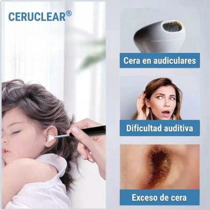 Ceruclear™ – Limpieza de oídos segura y visible (HD + LED + App)